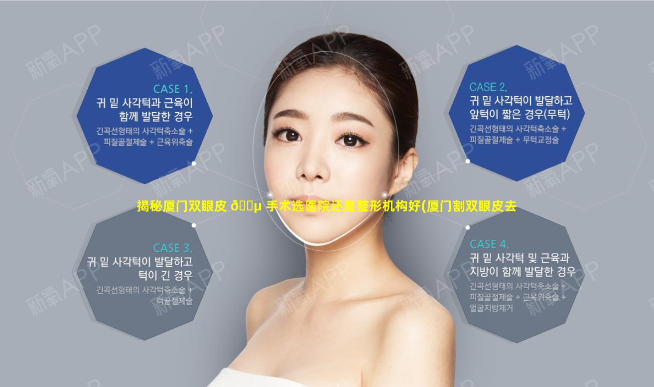 揭秘厦门双眼皮 🐵 手术选医院还是整形机构好(厦门割双眼皮去医院 🐱 好还是整形医院好)